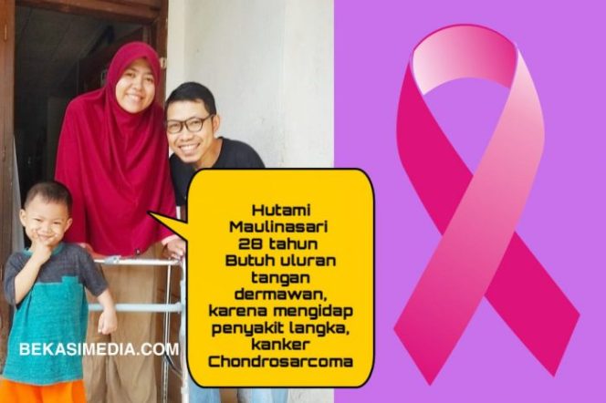 
 Idap Penyakit Langka Chondrosarcoma, Tami Butuh Uluran Tangan Donatur