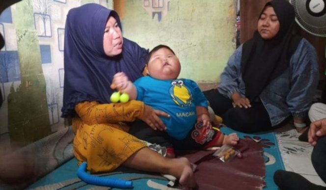 
 1440 Balita di Kabupaten Bekasi Terindikasi Obesitas, Paling Banyak di Desa Wanasari