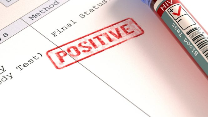 
 Kasus HIV Bekasi Paling Tinggi di Jawa Barat